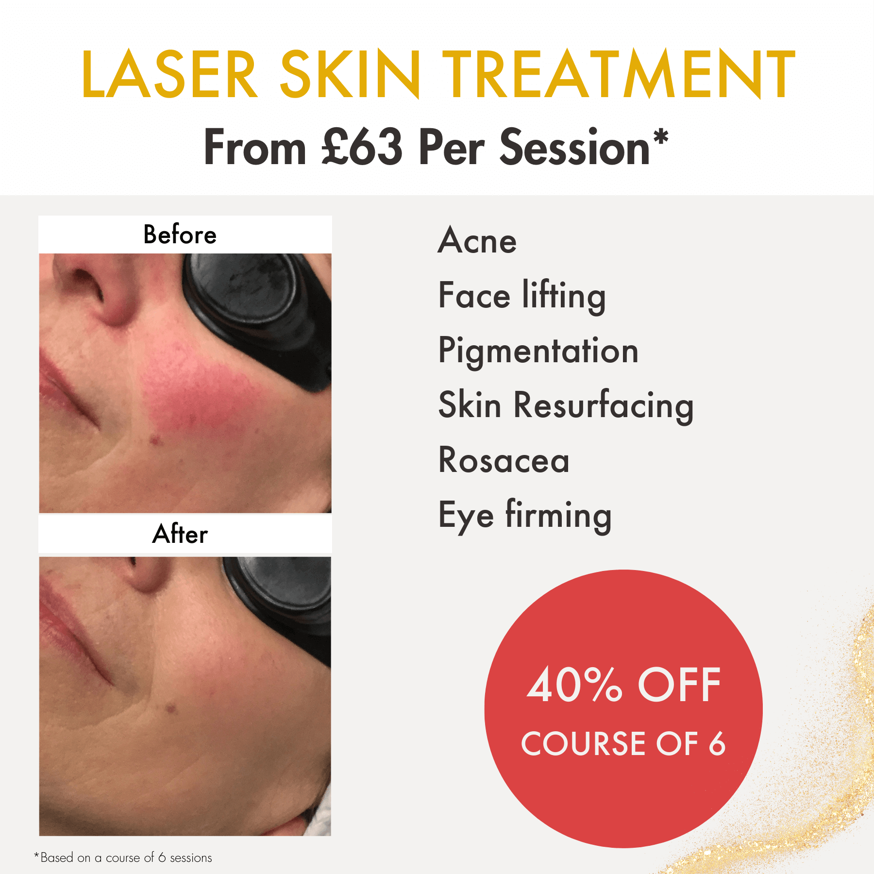 Laser Skin Treatment March 2024 Special offer