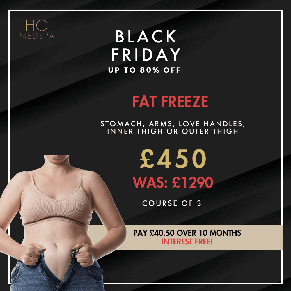 Black Friday Fat Freeze