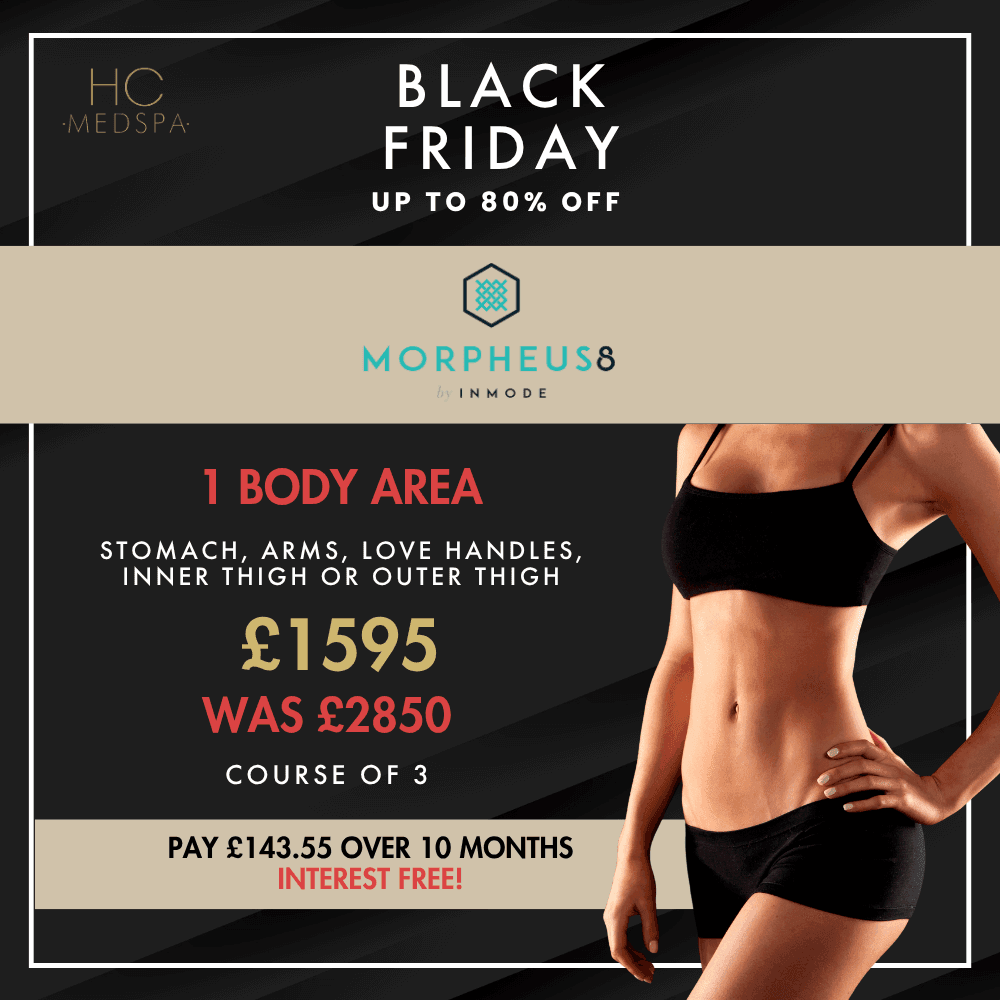 Black Friday M8 Body
