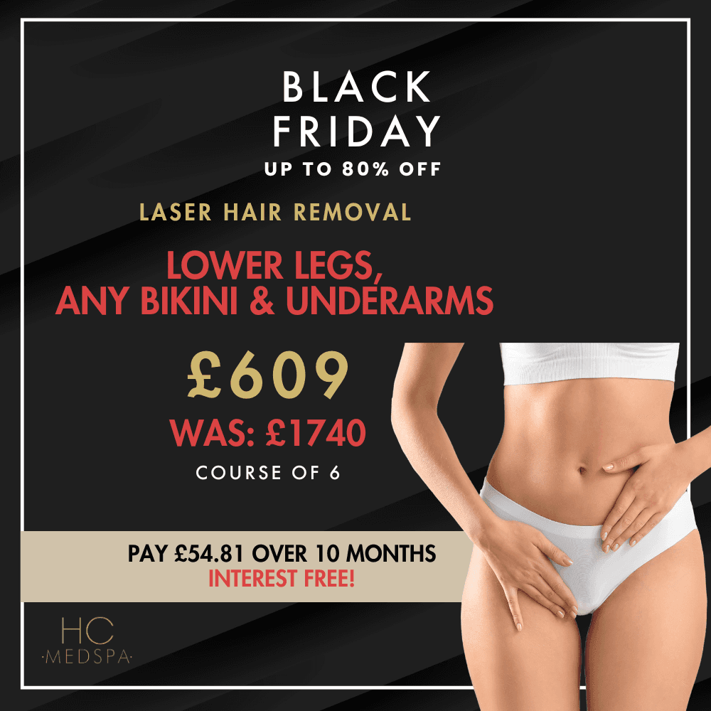 Black Friday – Lower Legs
